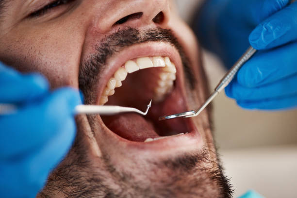 Best Tooth Extraction  in The College Of New Jersey, NJ